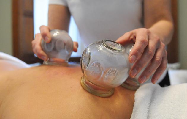 Cupping therapy